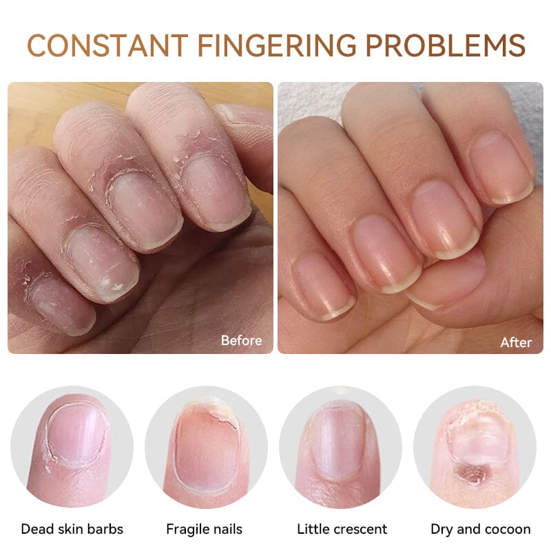 Cuticle Oil 5ml Tools & Accessories LILYCUTE 