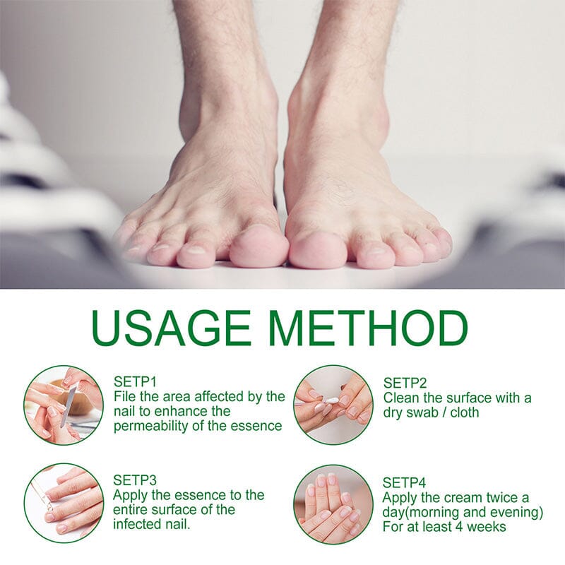 Ginger Nail Essence Fungus Treatment 30ml Nail Care No Brand 