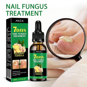 Ginger Nail Essence Fungus Treatment 30ml Nail Care No Brand 