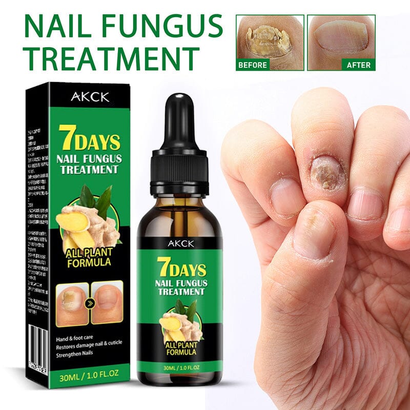 Ginger Nail Essence Fungus Treatment 30ml Nail Care No Brand 