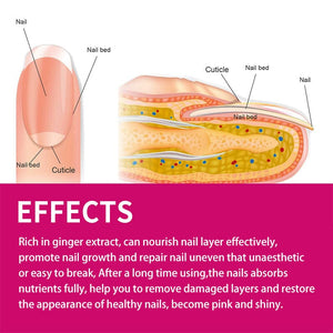 Ginger Nail Essence Repair Fungus Treatment 10ml Nail Care No Brand 