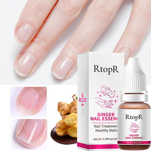 Ginger Nail Essence Repair Fungus Treatment 10ml Nail Care No Brand 