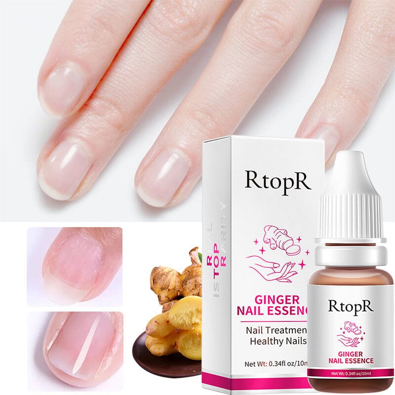 Ginger Nail Essence Repair Fungus Treatment 10ml Nail Care No Brand 