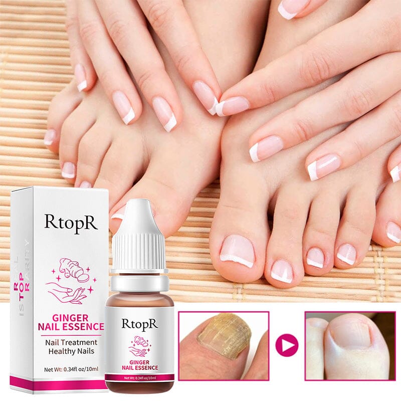 Ginger Nail Essence Repair Fungus Treatment 10ml Nail Care No Brand 